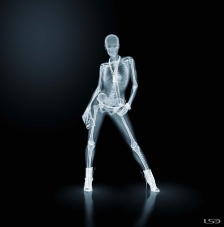 Рентген женщины