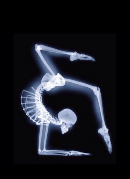 Скелет рентген