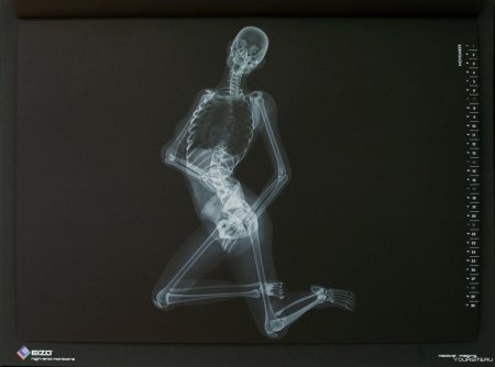 Скелет рентген