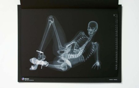 Рентген-сканер 2xr51