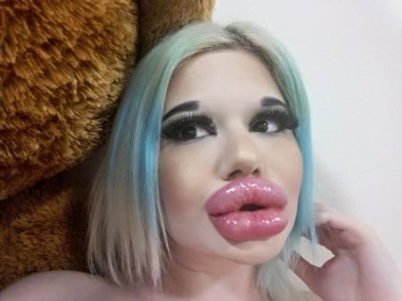 Блогерша с огромными губами