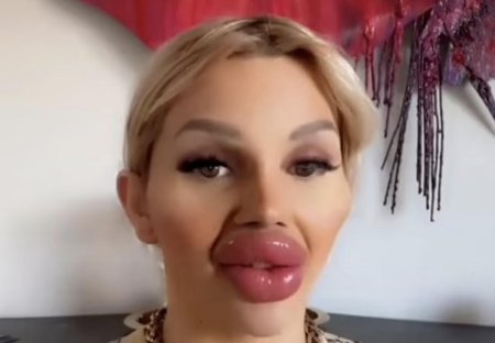 Женщина с самыми большими губами