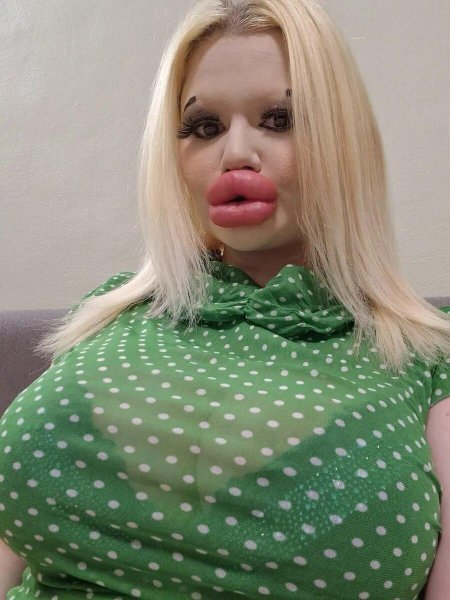 Самые большие губы в мире