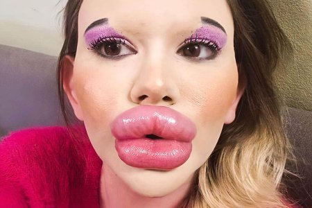 Девушка с огромными губами