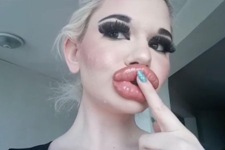 Обладательница самых больших губ