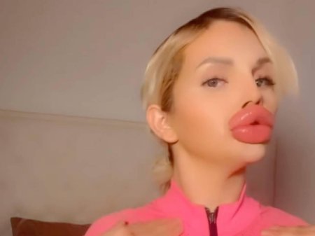 Амина с гигантскими губами
