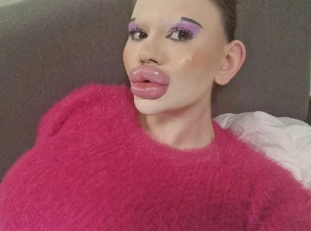 Самые большие губы в мире Андреа Иванова
