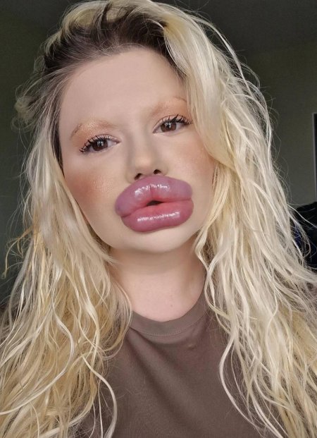 Самые большие губы в мире