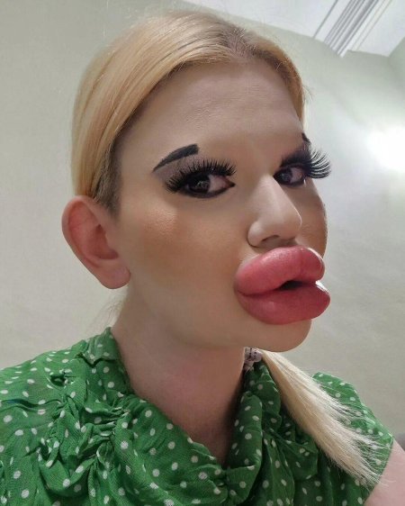 Андреа эмилова силиконовые губы