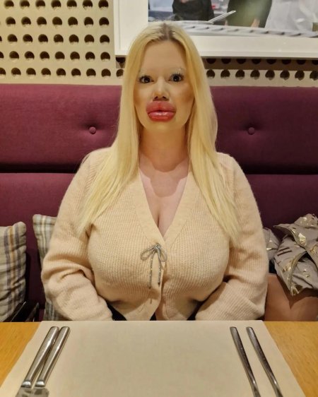 Девушка с самыми большими губами