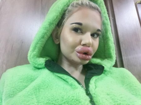 Иванова Болгария губы Андреа