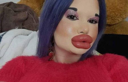 Девушка с самыми большими губами