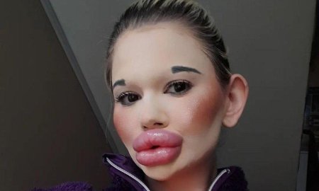Женщина с самыми большими губами