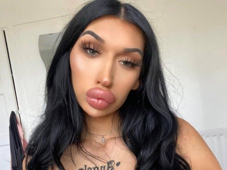 Девушка с увеличенными губами