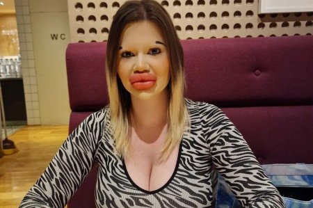 Иванова Болгария губы Андреа