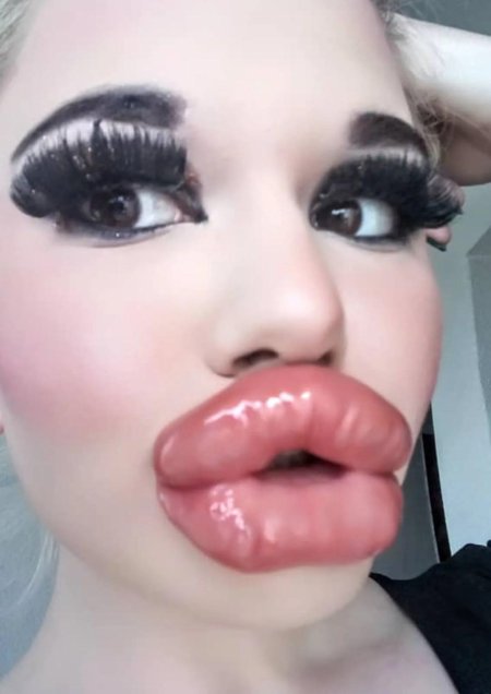 Самые большие силиконовые губы
