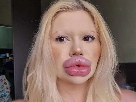 Огромные губы