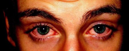 Красные глаза от наркотиков