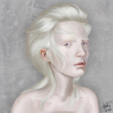 Rosie Crawford альбинос