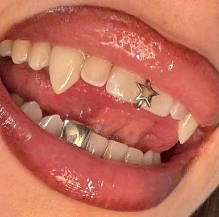 Пирсинг зуба