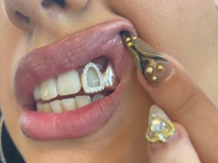 Украшение на зубы