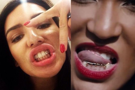 Украшения на зубы грилзы