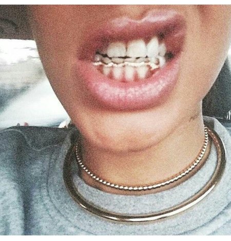 Грилзы на зубы