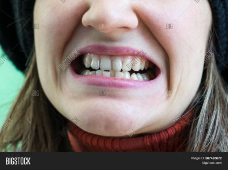 Девушка с кривыми зубами