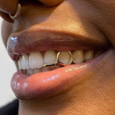 Diamond grillz