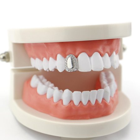 Керамическая накладка на зуб