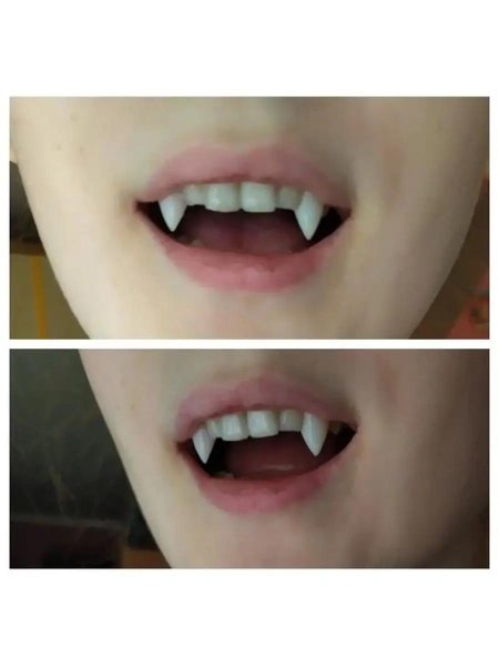 Декоративные клыки на зубы