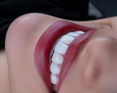 Ровные зубы