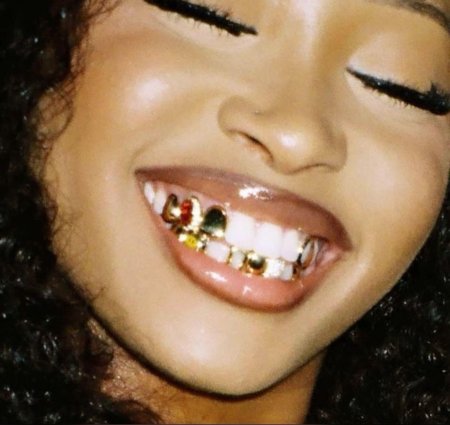 Gold grillz