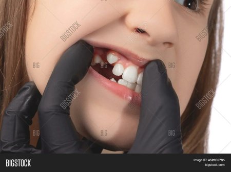 Зубы у детей