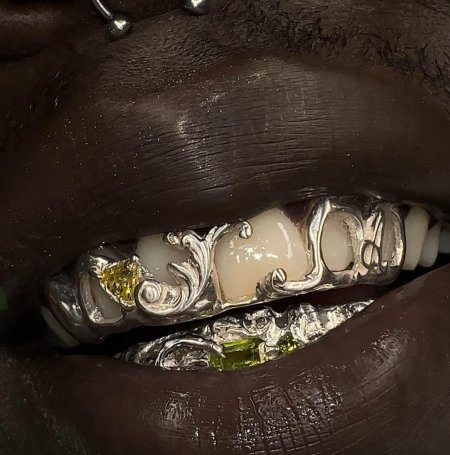 Зуб золотой