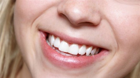 Улыбка с зубами