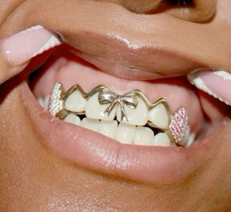 Золотые грилзы на зубы
