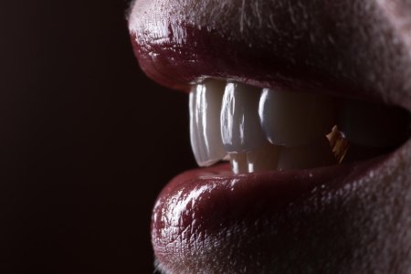 Зубы Аэстетика