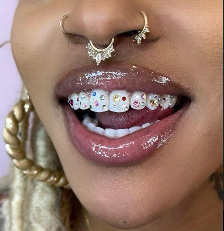 Пирсинг на зубах