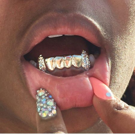 Зубы с бриллиантами