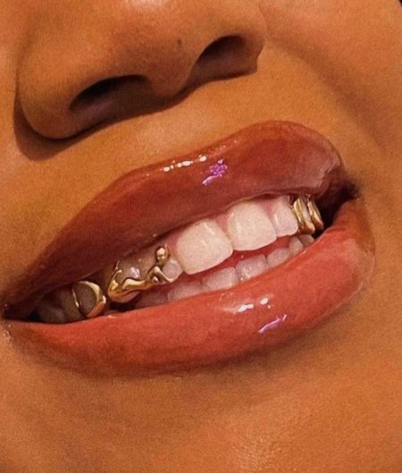 Золотой зуб