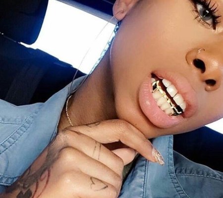 Золотые грилзы на зубы