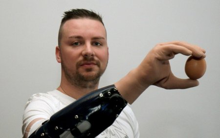 Протез руки