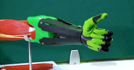 Бионические протезы