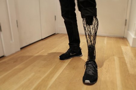 3d Printed prosthetics