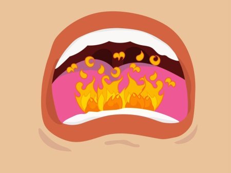 Горит рот