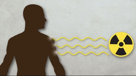 Ионизирующее излучение на человека