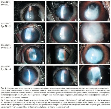 Эндотелиальная дистрофия роговицы