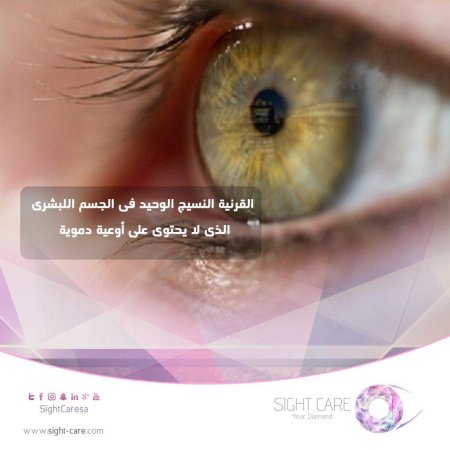 Старческая дуга (Arcus senilis)