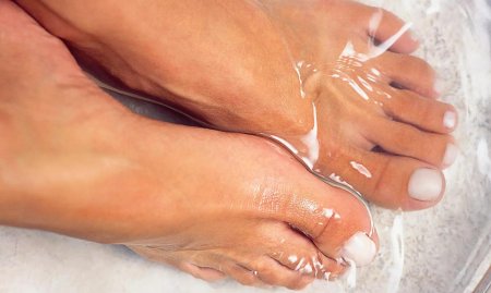 Подошвенный гипергидроз